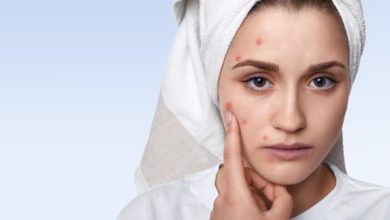 مشروبات تمنع ظهور حب الشباب