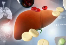 دواء للكبد الدهني